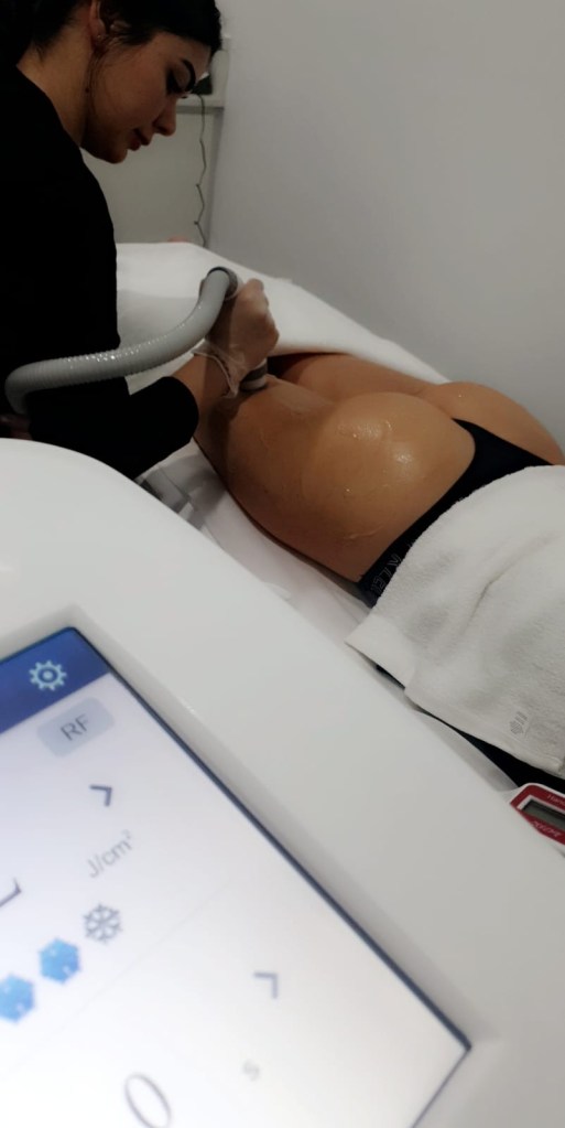 A person using a RFBBL treatment on another persons thigh